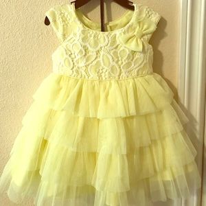 Yellow girls dress